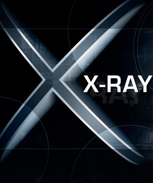 X-Ray SDK X-Ray SDK