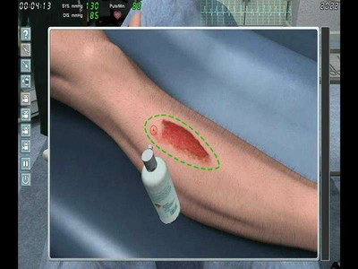 третий скриншот из Chirurgie-Simulator 2011 / Симулятор хирурга 2011