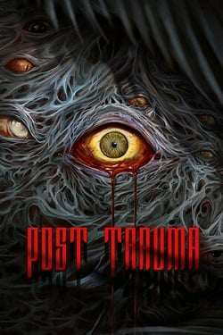 Post Trauma Post Trauma